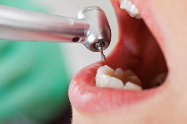 Best Emergency Treatment for Oral Infections in Oakland, OK